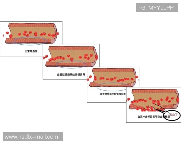 踢足球时意外受伤出血的原因与预防措施探讨